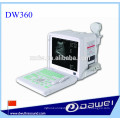 Equipamentos médicos máquina de ultra-som e monitor de ultra-som portátil DW360